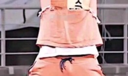 针灸不让吃瓜,遵循古法，瓜果禁忌，健康生活新篇章